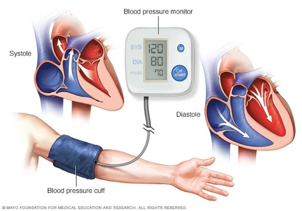 hipertensión graviola